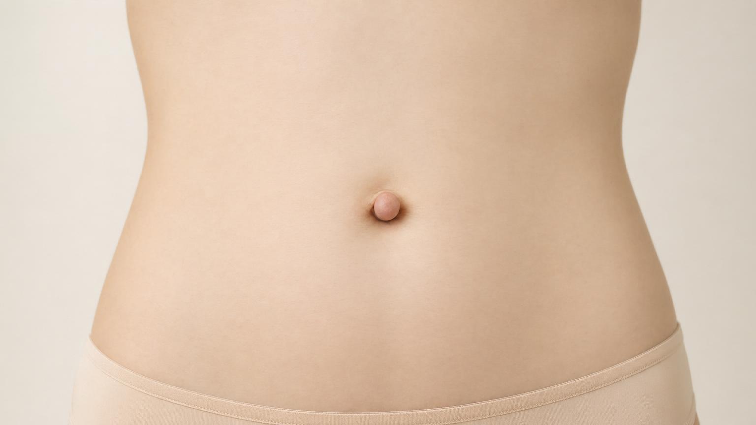 Type 1 outie belly button — a clear protruding navel from an umbilical hernia or thickened scar tissue