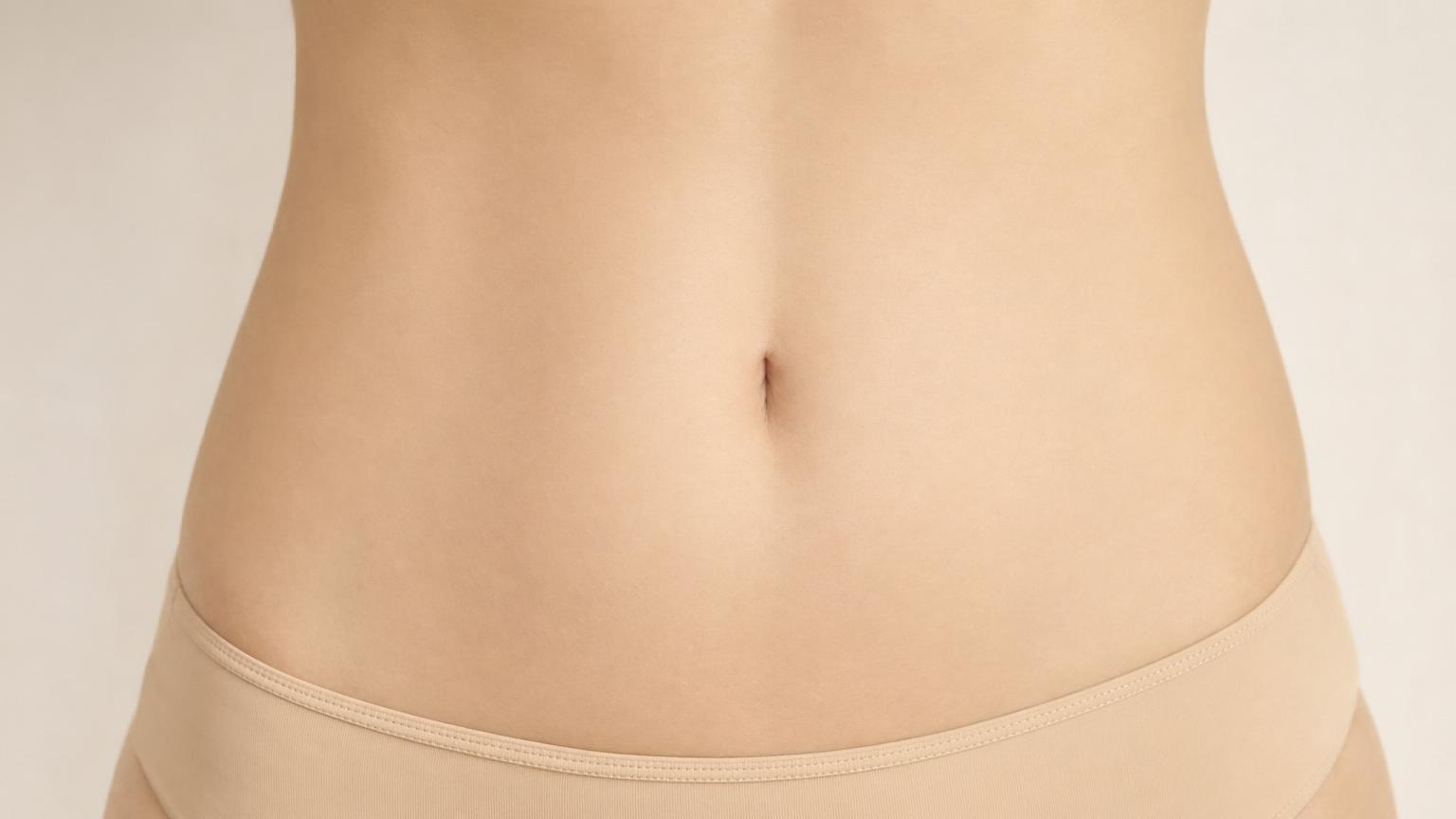 Three months after Korean umbilicoplasty showing the final settled narrow vertical slit-shaped belly button with smooth skin and no visible scar