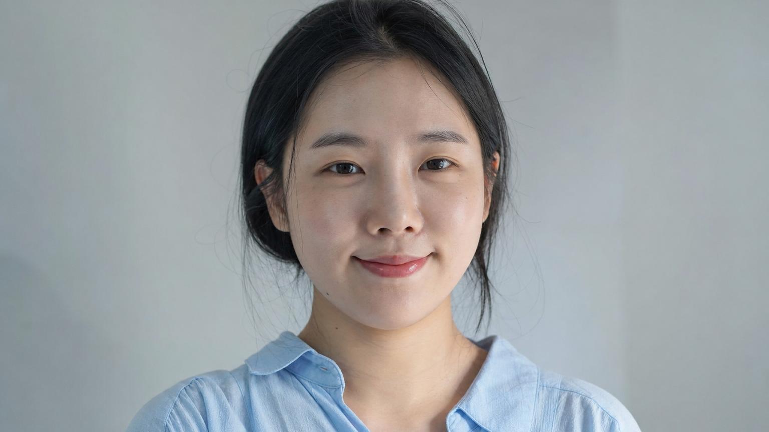 Korean woman one month after rhinoplasty — bruising and major swelling resolved, residual mild tip swelling still subtly visible at this stage